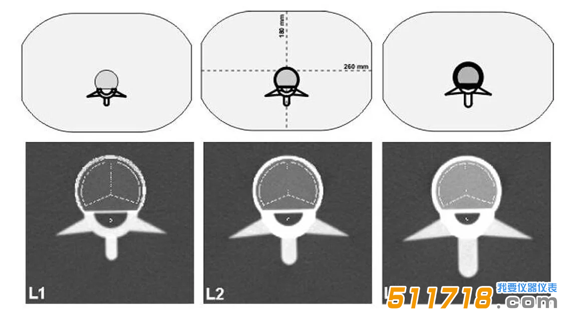 1768967743112363.png QRM-ESP 的 CT 圖像。椎體中段掃描圖像,并疊加了自動(dòng)確定的松質(zhì)骨和皮質(zhì)骨 ROI。.png