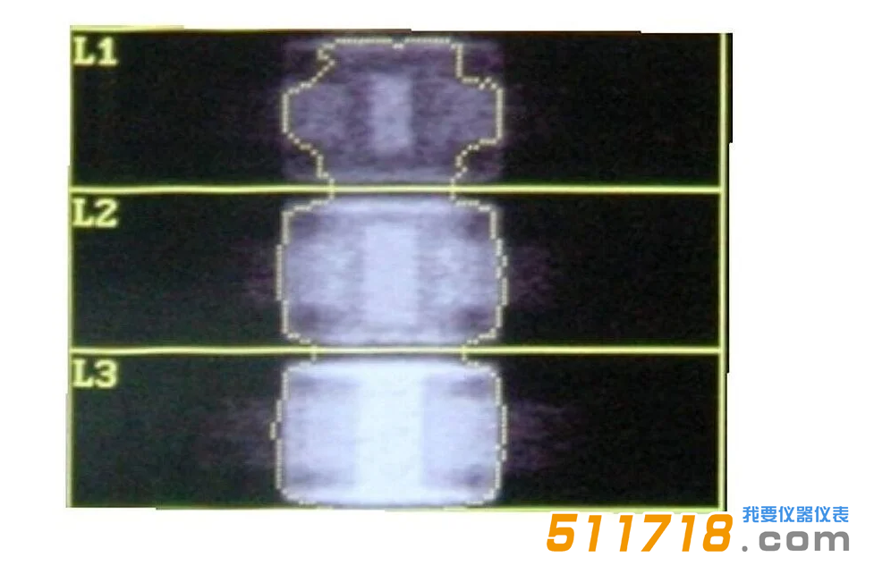 1768967767878828.png QRM-ESP 的 DXA 掃描(說(shuō)明見(jiàn)以上文字) (1).png